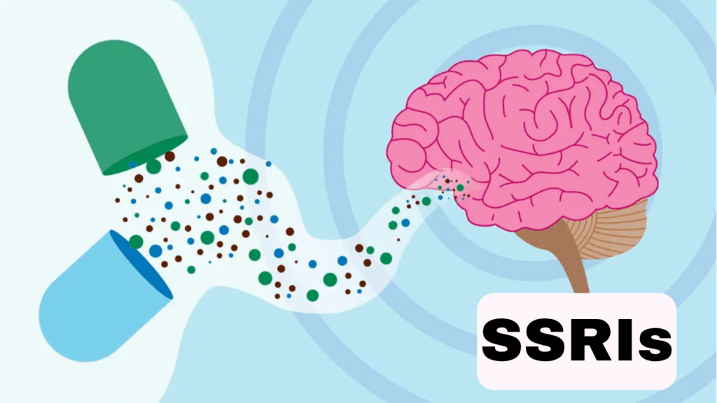 SSRI